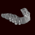 Industry Insider: After 3M Separation, Solventum Targets Digital Integration in Ortho