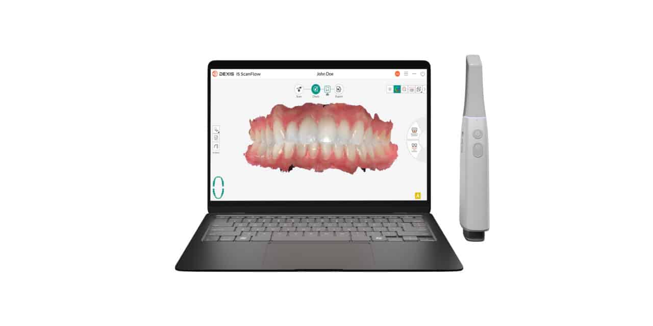 DEXIS Launches Imprevo Intraoral Scanner with IS ScanFlow 2.0