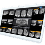 How Pearl’s AI Radiograph Tools Are Reshaping Orthodontic Practices