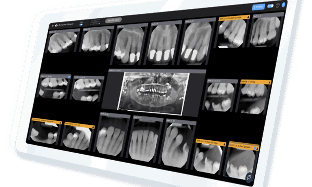 How Pearl’s AI Radiograph Tools Are Reshaping Orthodontic Practices