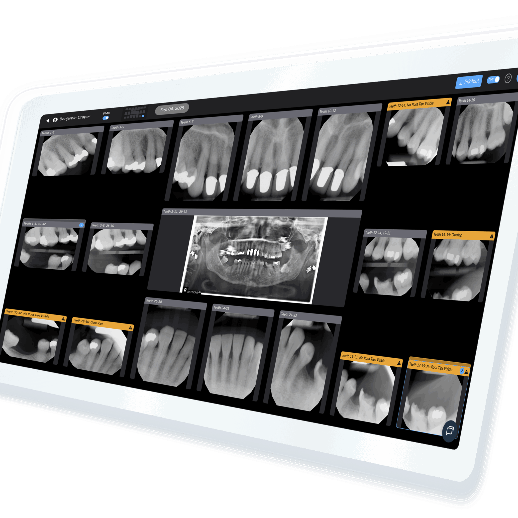 Ophir Tanz on AI Orthodontic Radiographs and Pearl's Imagecheck