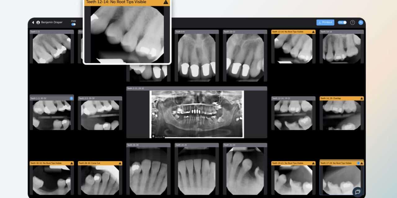 New Pearl Software Flags Dental Radiograph Errors at Time of Capture