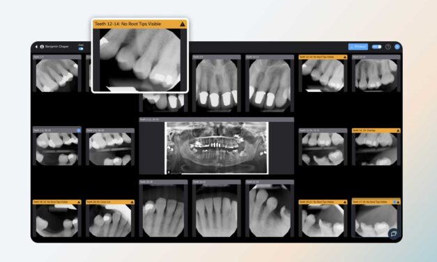 New Pearl Software Flags Dental Radiograph Errors at Time of Capture
