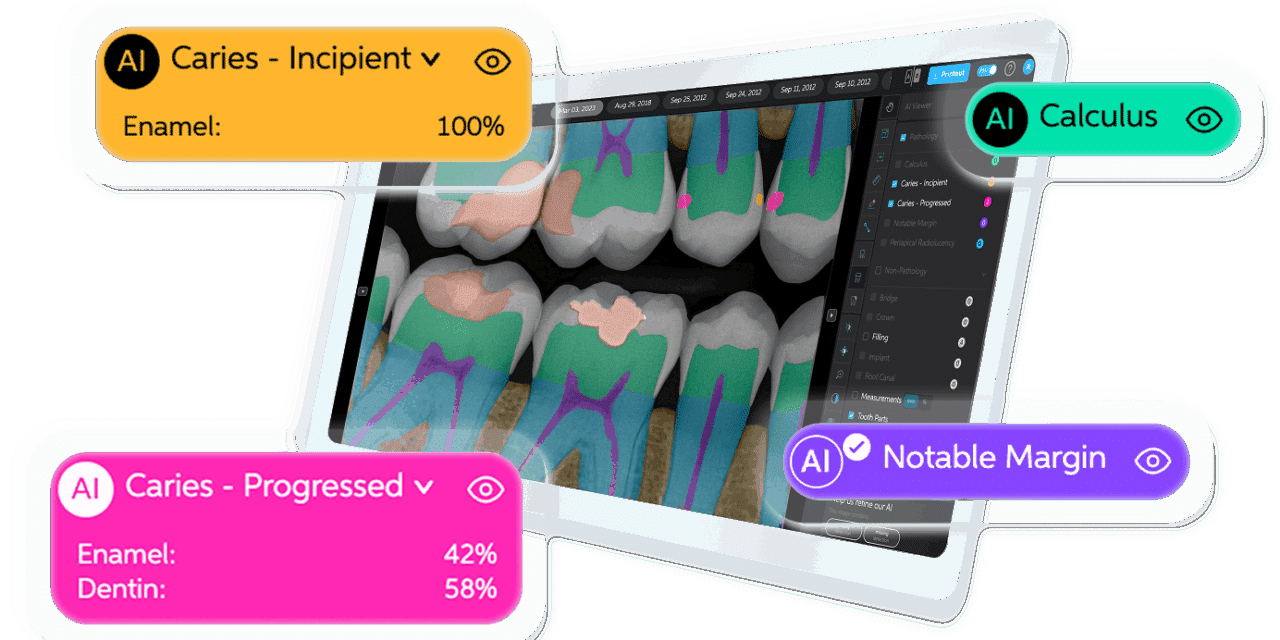 Dentsply Sirona and Pearl Partner on AI Radiology Integration