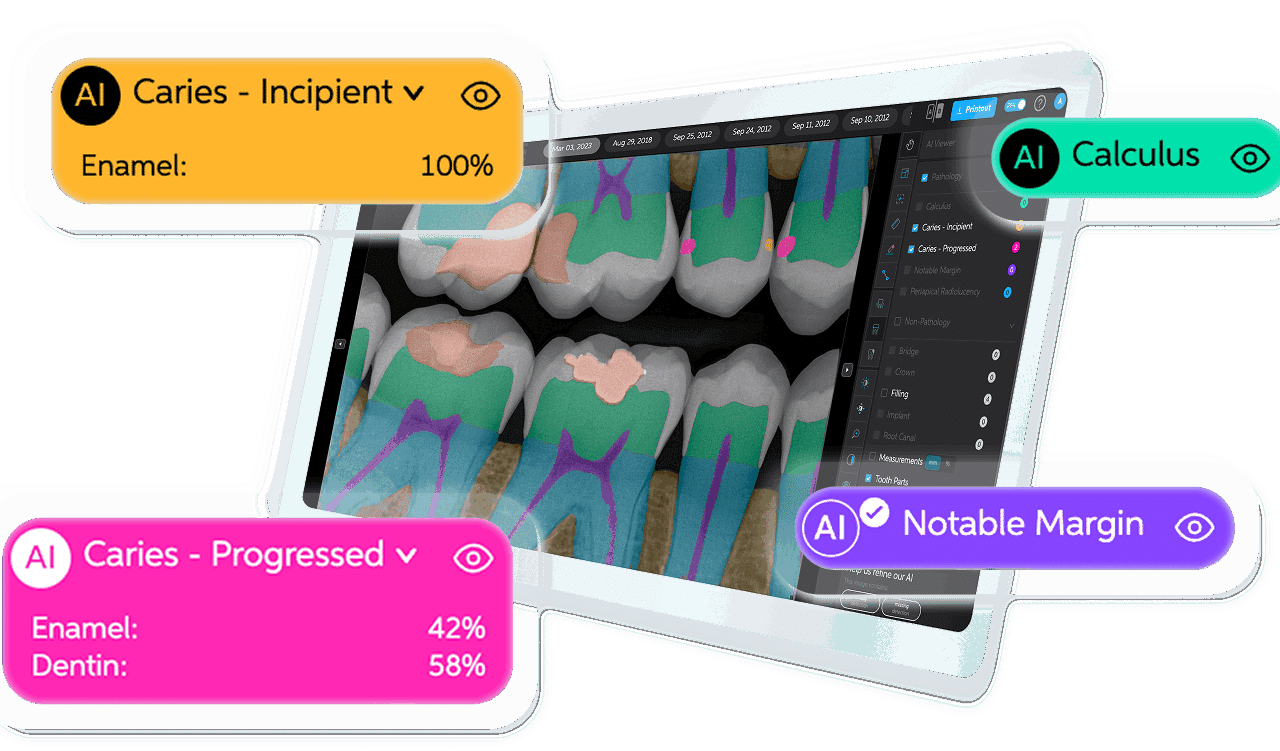 Dentsply Sirona and Pearl Partner on AI Radiology Integration