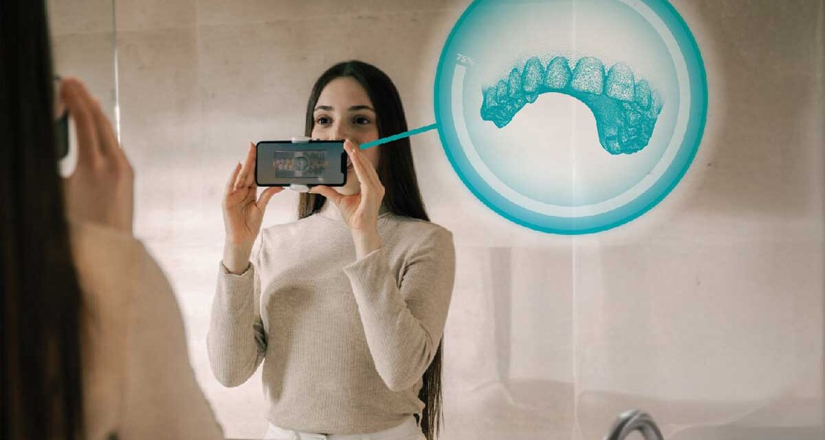 New Smartee-Dental Monitoring Integration Eliminates In-Office Scans for Refinement