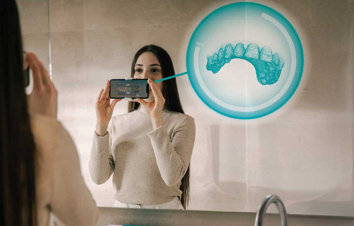 New Smartee-Dental Monitoring Integration Eliminates In-Office Scans for Refinement