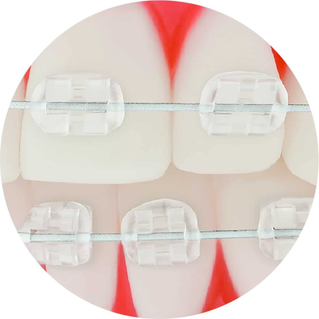 TP Orthodontics Aesthetic Archwires