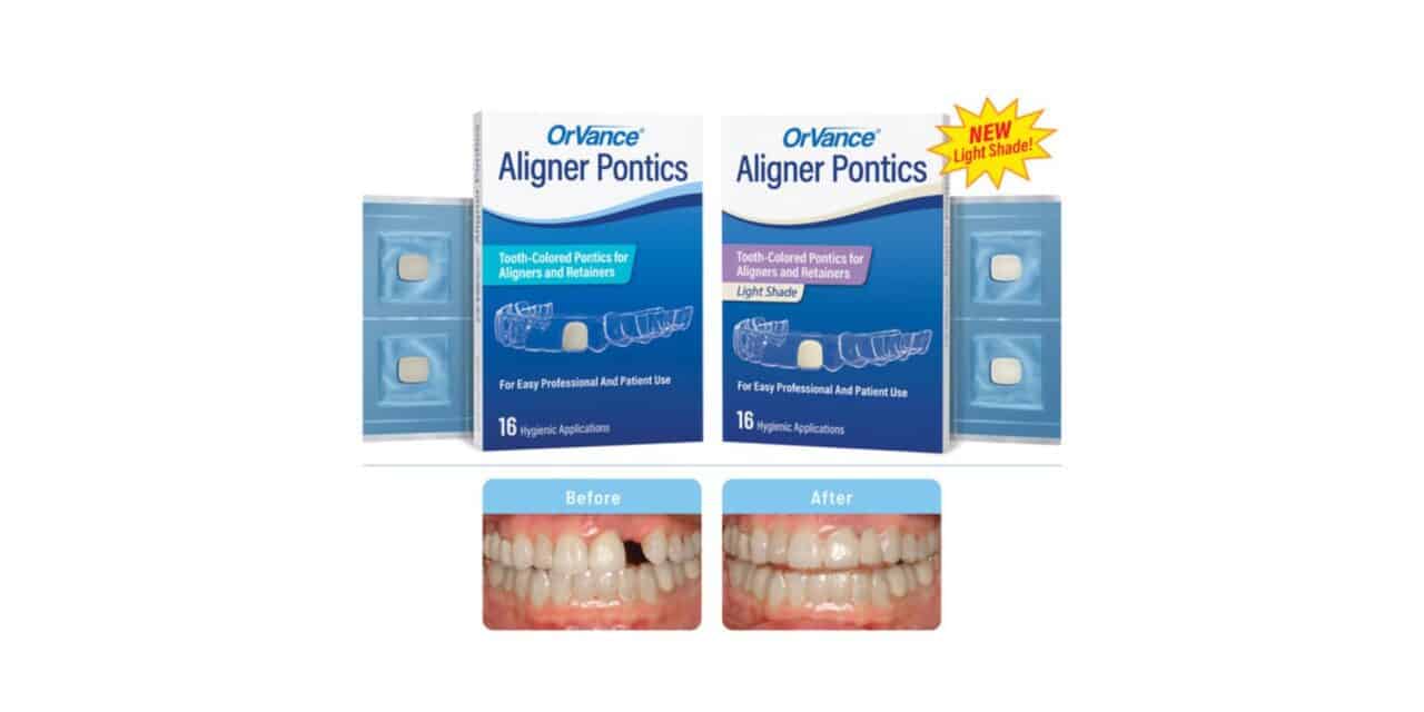 OrVance Aligner Pontics Update Adds Light Shade and Retainer Use