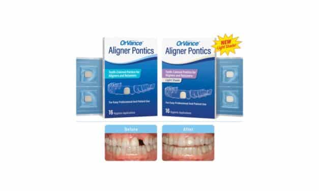 OrVance Aligner Pontics Update Adds Light Shade and Retainer Use