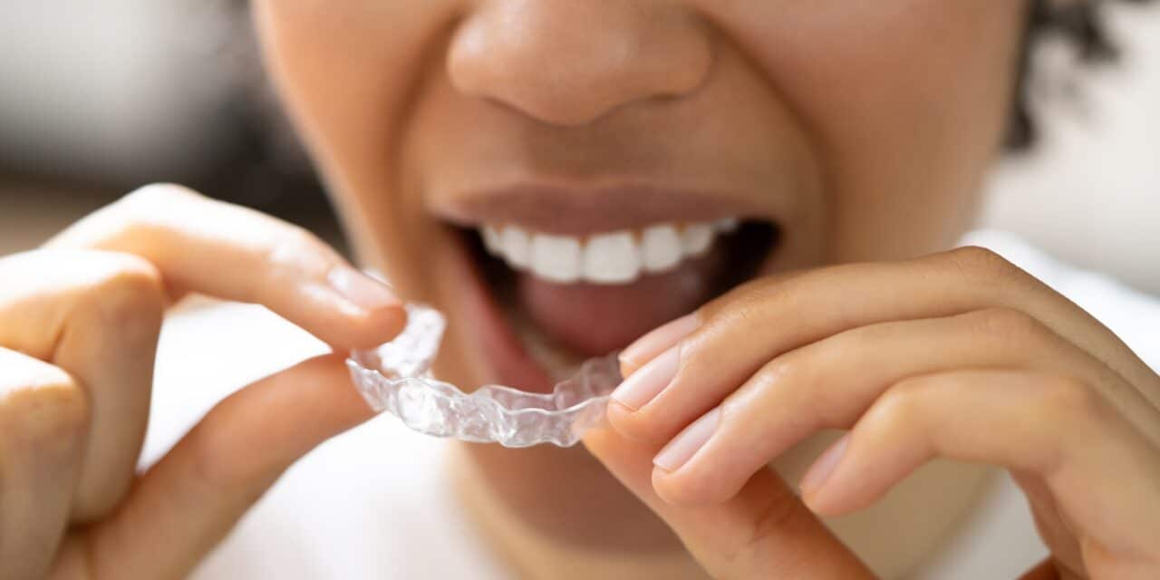 New Medit Aligners Now Available Through Medit Orthodontic Suite