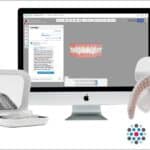 New uLab-Biolux Partnership Combines Light Therapy with Clear Aligners