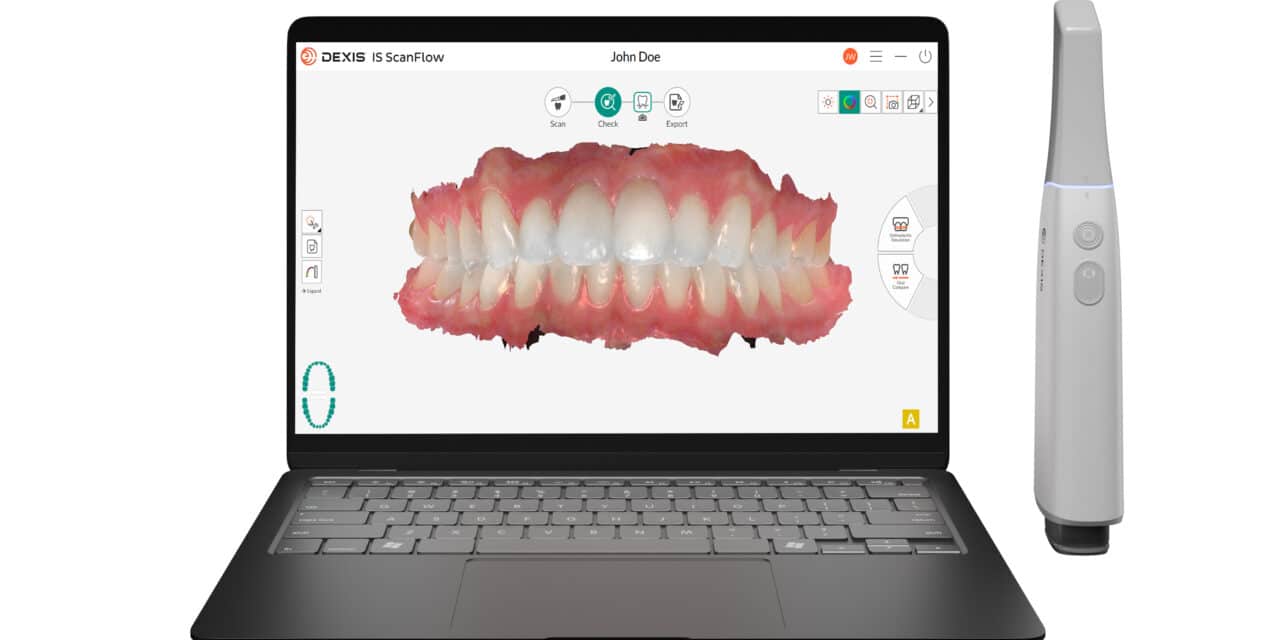 Wireless Imprevo Intraoral Scanner with IS ScanFlow 2.0 Joins DEXIS Lineup