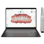 Wireless Imprevo Intraoral Scanner with IS ScanFlow 2.0 Joins DEXIS Lineup