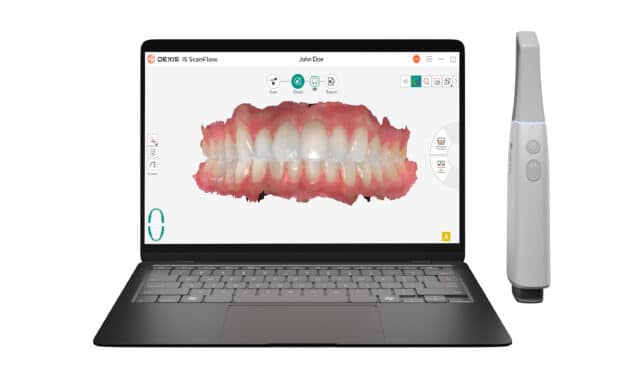 Wireless Imprevo Intraoral Scanner with IS ScanFlow 2.0 Joins DEXIS Lineup