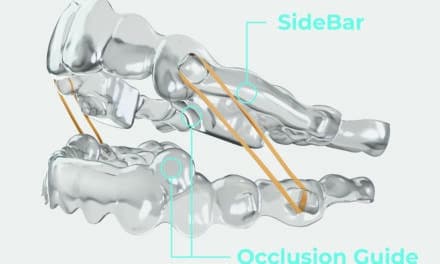 Navigating the Class II Malocclusion with a Single System