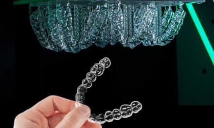 Angelalign Invests in LuxCreo to Co-Develop Next-Generation Clear Aligner Materials