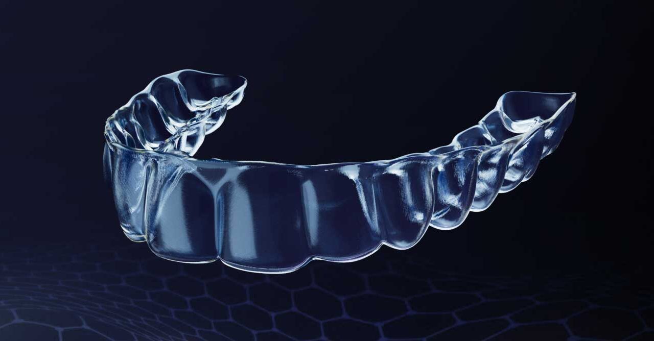 A Closer Look at OrthoFX’s PrecisionFinish Aligners and Their Clinical Impact