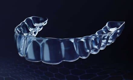 A Closer Look at OrthoFX’s PrecisionFinish Aligners and Their Clinical Impact