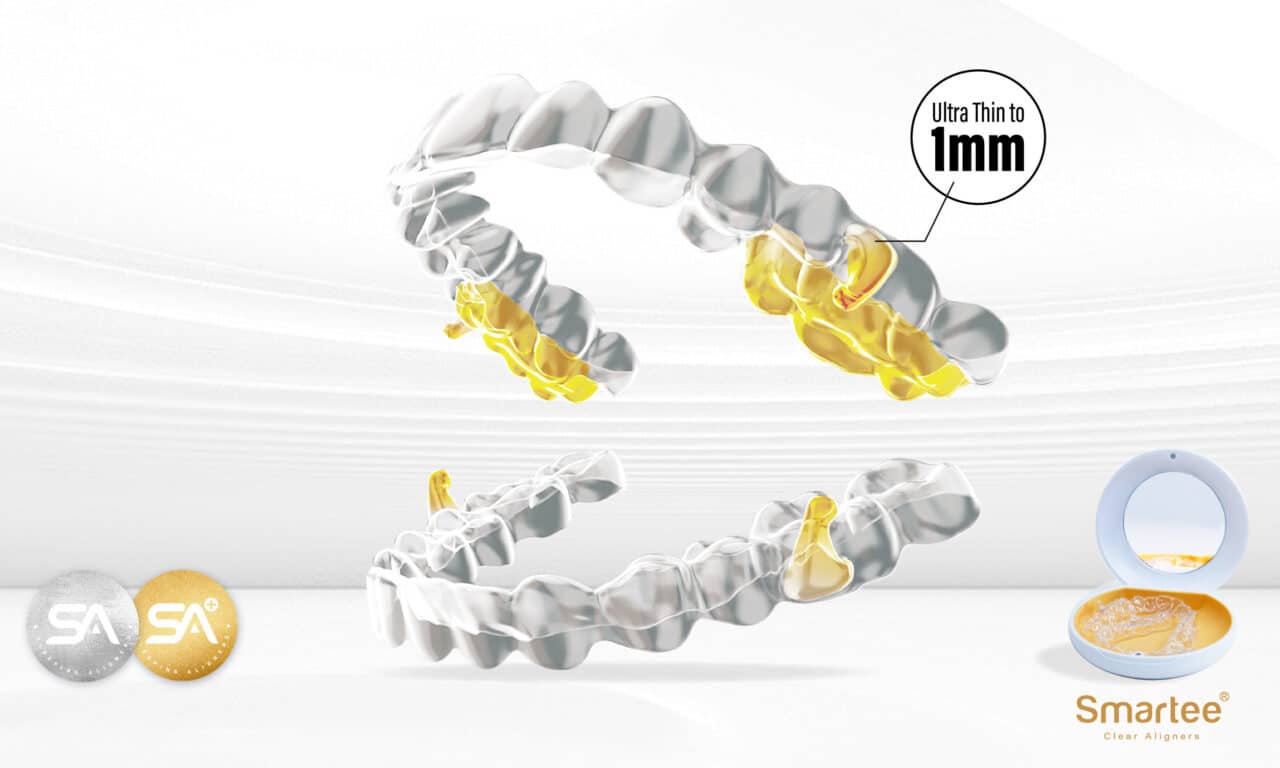 New Smartee Aligners Target Sleep Apnea and Orthodontic Needs