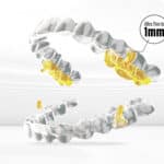 New Smartee Aligners Target Sleep Apnea and Orthodontic Needs