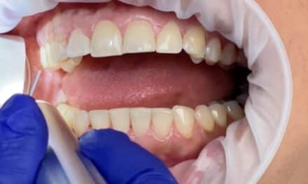 Geistlich Introduces Latex-Free Retractor for Dental Procedures