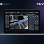 SOTA Cloud and Overjet Complete Integration of Clinical AI into Imaging Platform