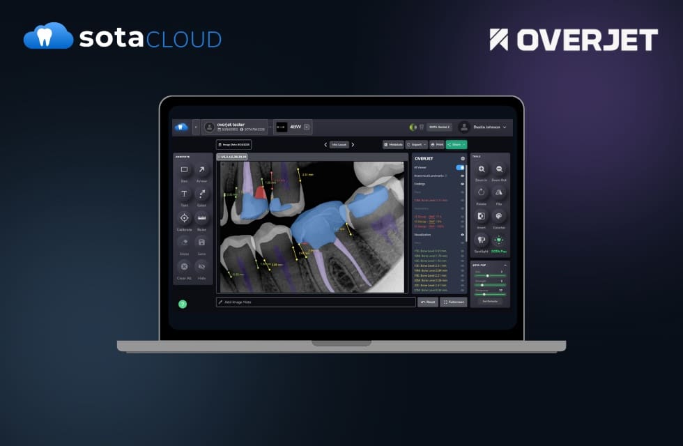 SOTA Cloud and Overjet Complete Integration of Clinical AI into Imaging Platform