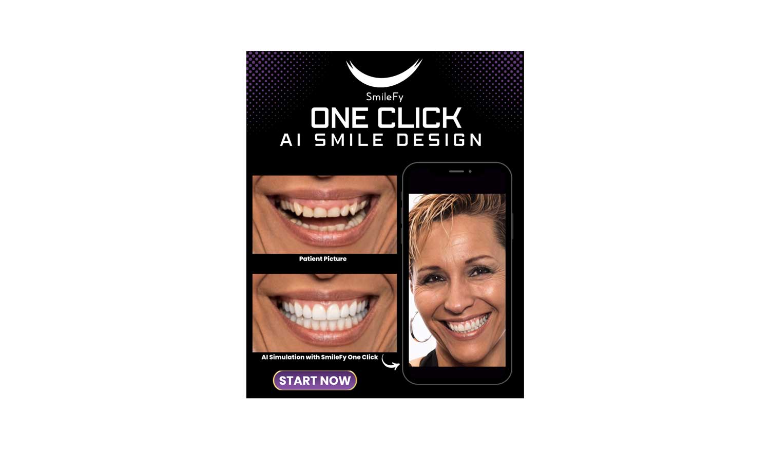 smileページ SmileFy Launches One-Click AI Smile Design Tool