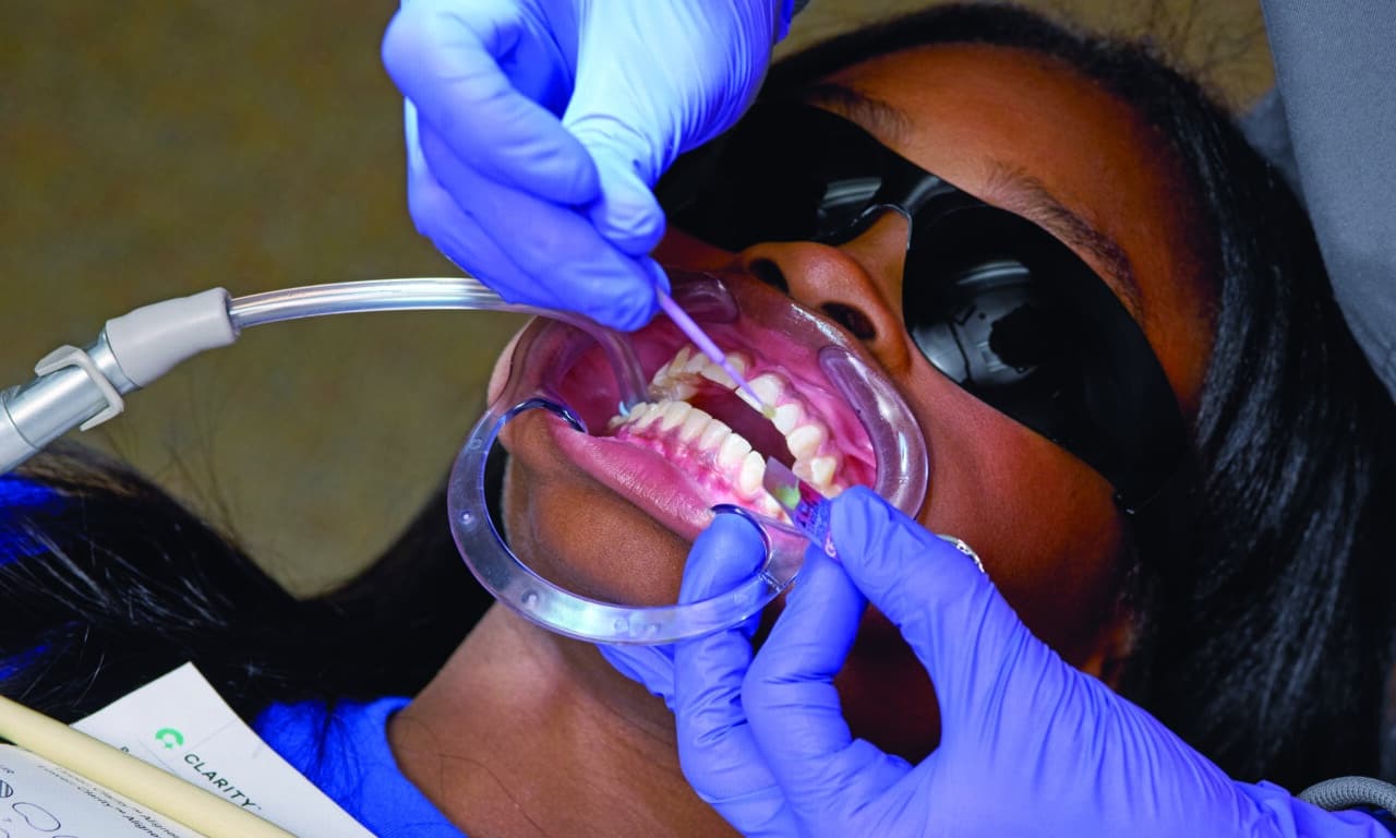 The Bonding Materials Driving Same-Day Starts