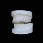 Inman Digital Splint Solves Common Fit and Warping Issues