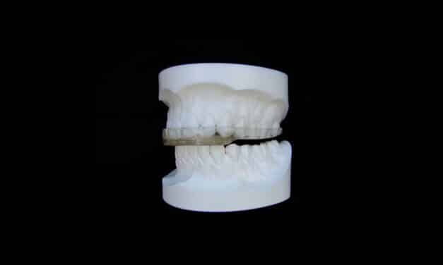 Inman Digital Splint Solves Common Fit and Warping Issues