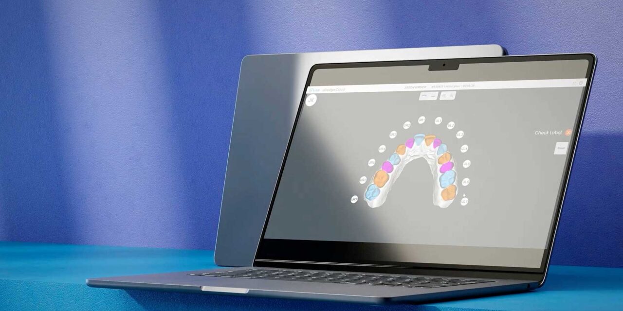 uLab Systems Releases uDesign Cloud 2.0 With Full Cloud-Based Aligner Workflow