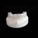 Inman Orthodontic Laboratories Targets Retainer Breakage and Costs with Hybrid Approach