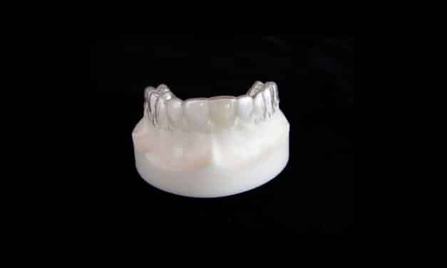 Inman Orthodontic Laboratories Targets Retainer Breakage and Costs with Hybrid Approach