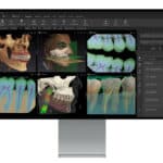 DEXIS Updates DTX Studio Platform With New AI Features and Integrations