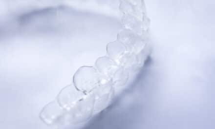 Dentsply Sirona and Dreve Advance Clinical Evaluation of Direct Aligner Resin