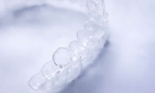 Dentsply Sirona and Dreve Advance Clinical Evaluation of Direct Aligner Resin