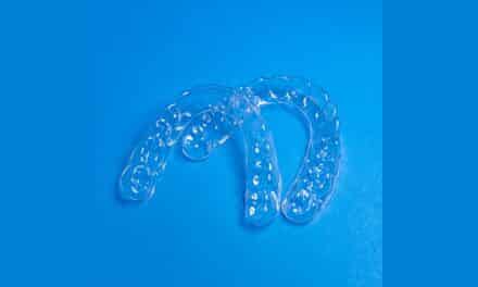 Prevent Relapse Risks with Immediate Retention Using Guardian Invisible Retainers