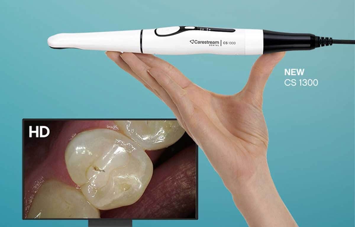 Carestream Dental Launches CS 1300 Intraoral Camera