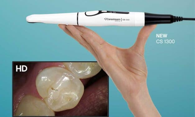 Carestream Dental Launches CS 1300 Intraoral Camera