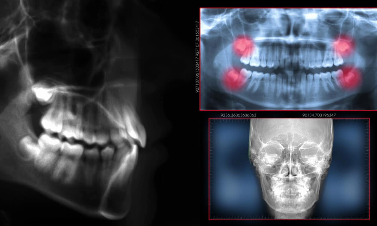 ADA Pushes for Federal Standards on Dental Imaging Data Exchange