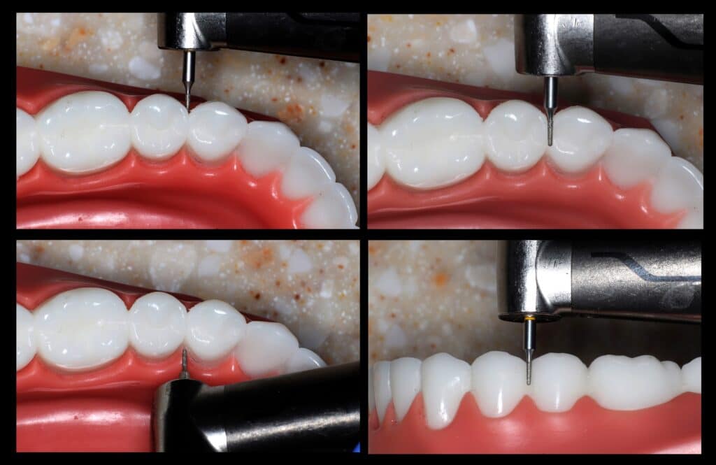 Figure 5: Cylindrical shape of Cali-Bur means can be held vertically or horizontally.