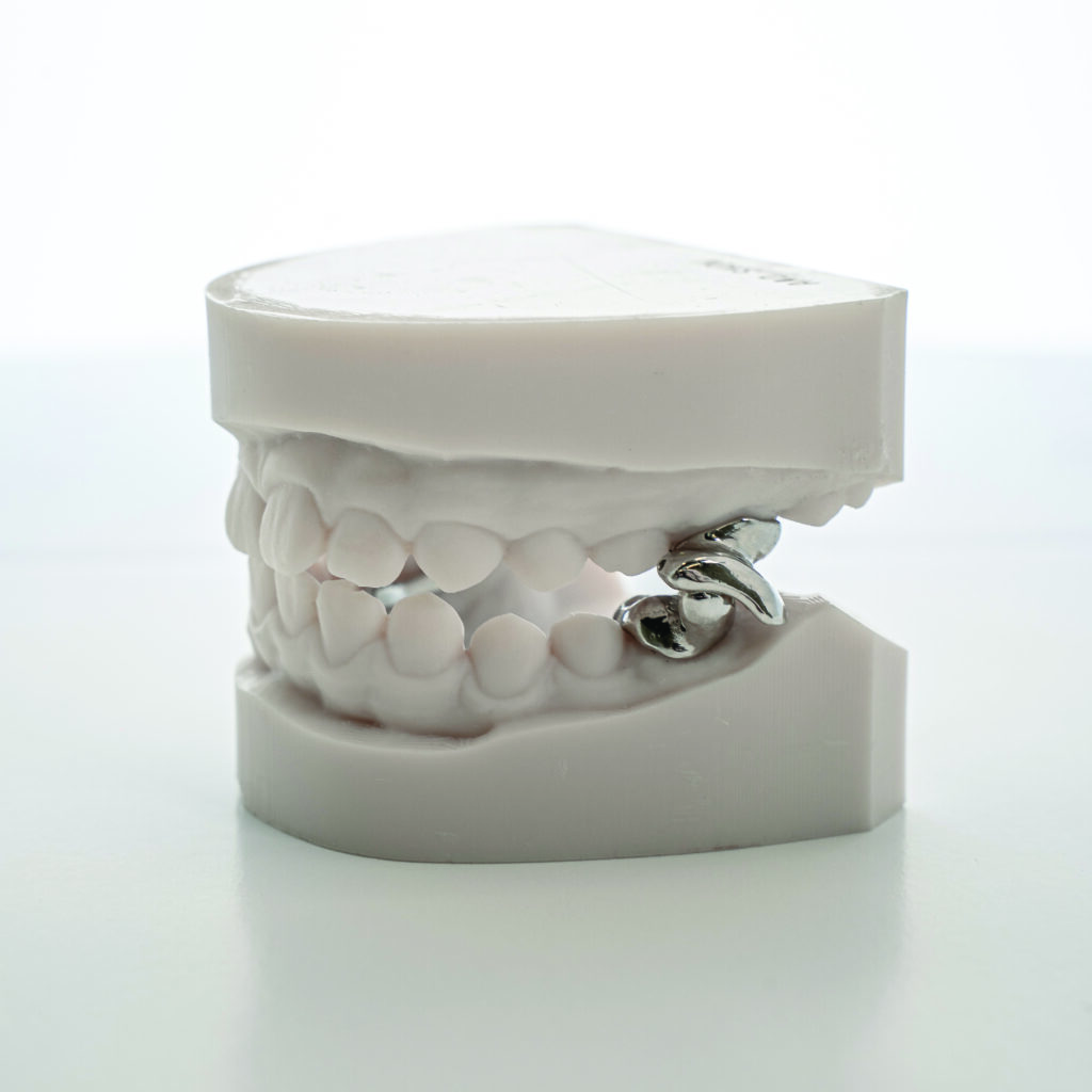 Casper Class II Corrector