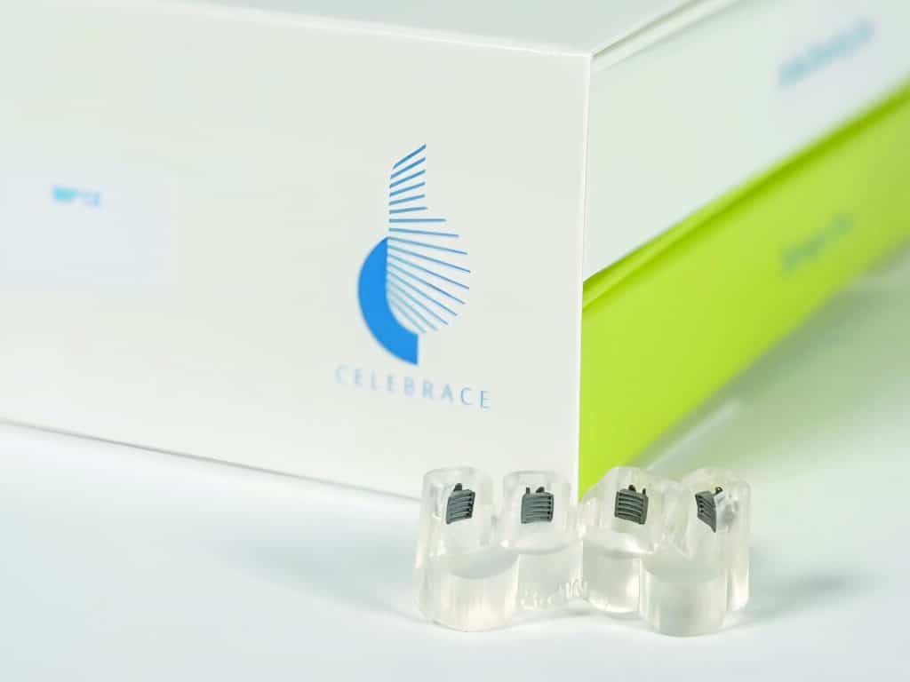 Celebrace 3D printed custom metal brackets