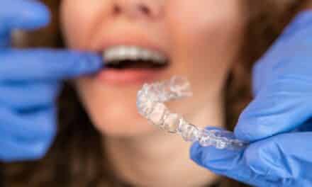 How Three Orthodontists Achieved Faster Finishes and Fewer Refinements With Spark Aligners