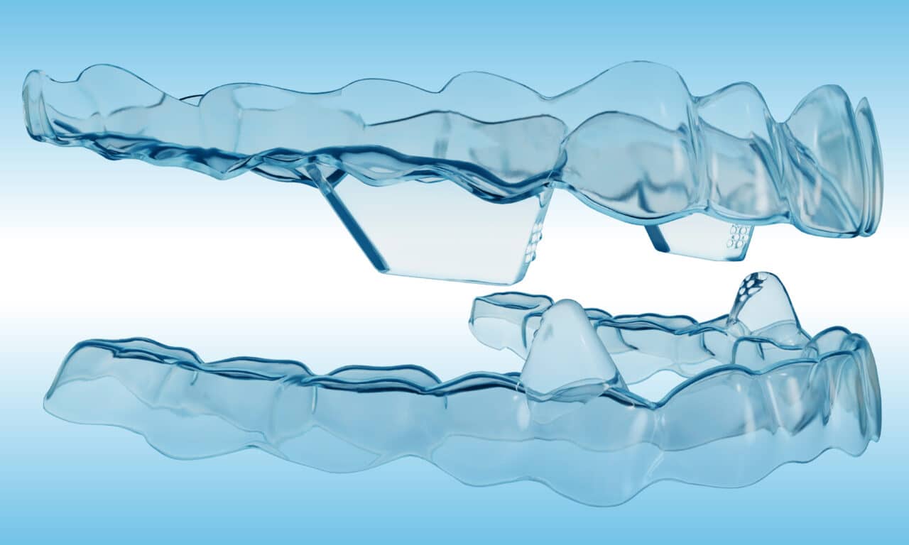 Angel Aligner Leverages 23 Years of Global Data as It Expands Its U.S. Footprint