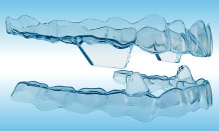 Angel Aligner Leverages 23 Years of Global Data as It Expands Its U.S. Footprint