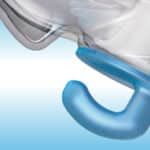Streamlining Maxillary Protraction in Growing Patients with angelHook