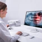 Research Team Publishes New Classification System for Malocclusions